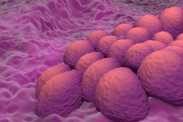 Cáncer de Endometrio: un modelo de IA diagnostica con una precisión casi perfecta
