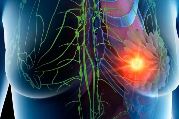 Clairity revoluciona la detección del cáncer de mama con IA aprobada por la FDA